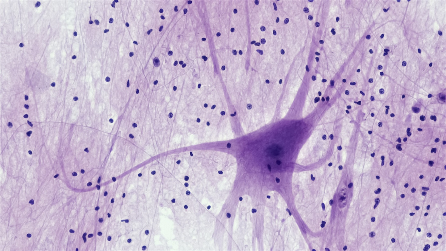 La importancia de la neuroestimulación en medicina